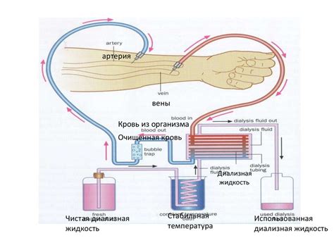 Преимущества домашнего диализа