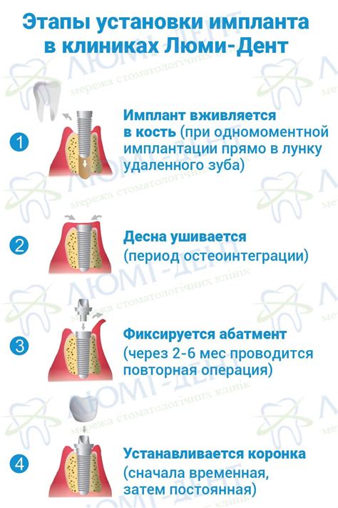 Приготовление икори: этапы и рекомендации