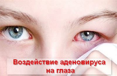Признаки болезни и возможные осложнения