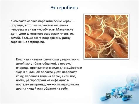 Признаки и симптомы энтеробиоза