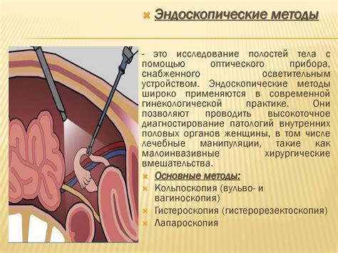 Принципы проведения операции