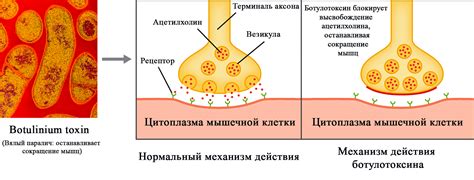 Принцип действия ботулотоксина