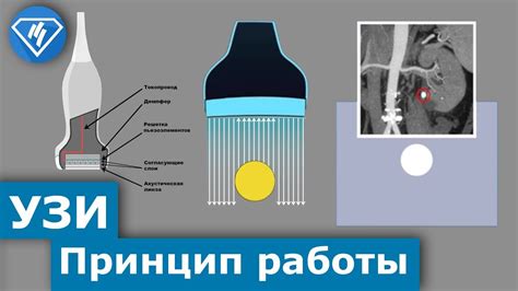 Принцип действия и механизмы воздействия при использовании аппарата Аврора