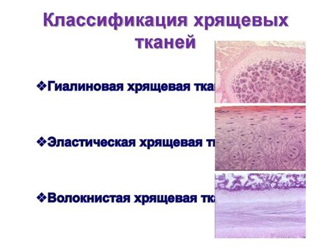 Принцип работы рентгенографии хрящевых тканей и возможности исследования