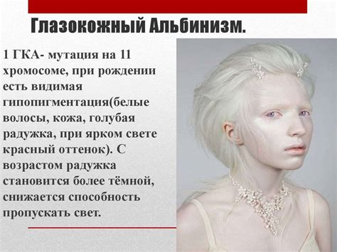 Причины возникновения альбиносов