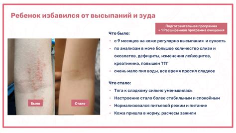 Причины высыпаний и зуда