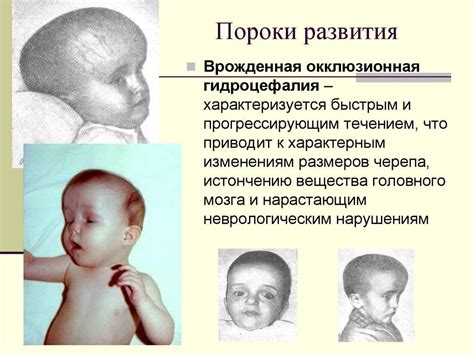 Причины гидроцефалии у взрослых
