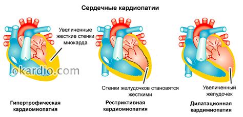 Причины и механизм развития слабой работоспособности сердца