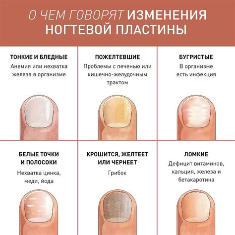 Причины и последствия оторванного ногтя