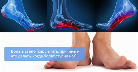 Причины наступления на пятки