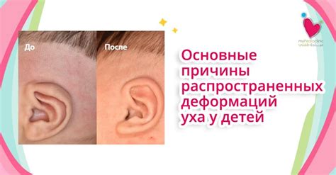 Причины опущенных ушей