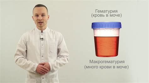 Причины появления мочи