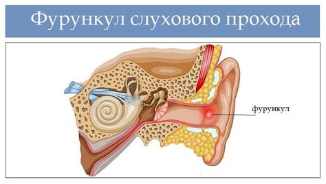 Причины появления наружного зева, пропускающего 1 палец