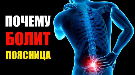 Причины проблемы с прогибом в пояснице