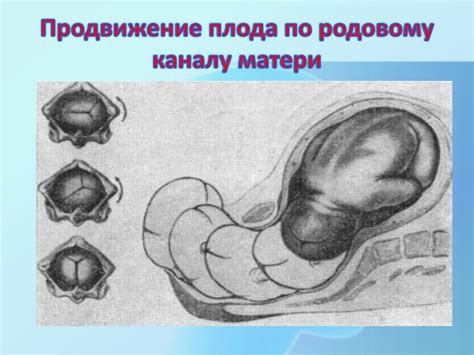 Причины прокалывания плода во время родов