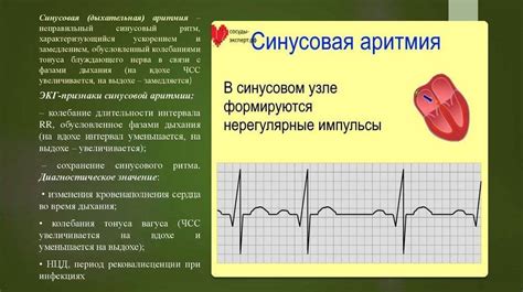 Причины развития дыхательной аритмии у детей