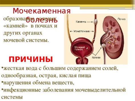 Причины формирования недостаточно отражающих звук пирамидок в органах мочевыделительной системы