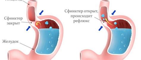 Причины функциональной недостаточности желудка