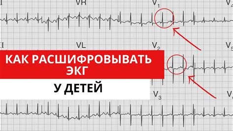 При необходимости проведения ЭКГ у ребенка: рекомендуемый набор предметов