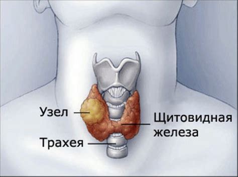 Проверка щитовидной железы на увеличение