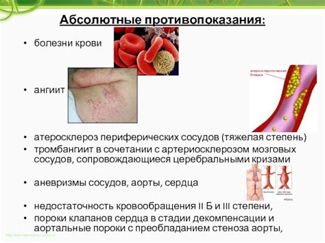Противопоказания к массажу сосудов