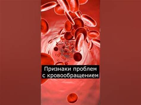 Профилактика и предупреждение возникновения проблем с кровообращением
