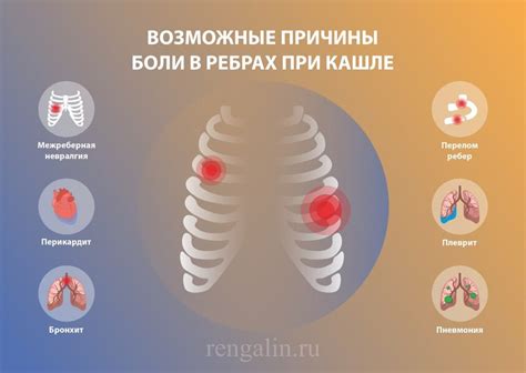 Профилактика нароста на ребре у взрослых