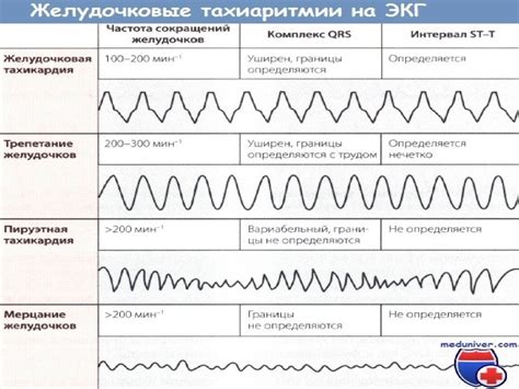 Профилактика нарушения динамики корковых ритмов