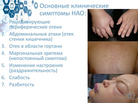 Профилактика наследственного ангионевротического отека