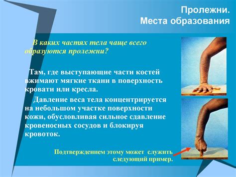 Профилактика ослабления двигательной активности у людей, перенесших инсульт