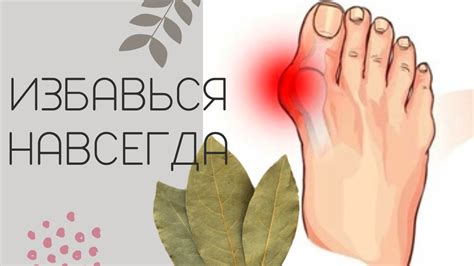 Профилактика появления шишки на сфинктере