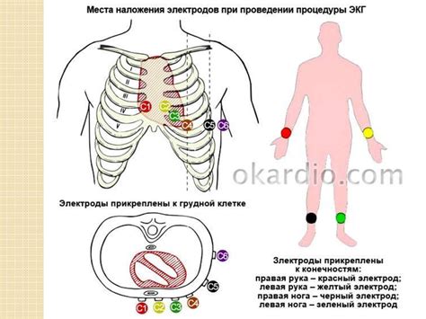 Различные способы фиксации электродов при проведении ЭКГ у маленьких пациентов