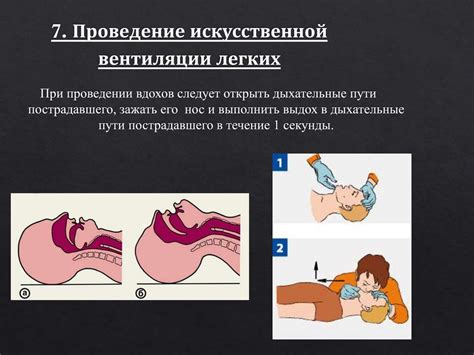 Разнообразные обстоятельства, при которых необходимо проведение артифициальной вентиляции легких