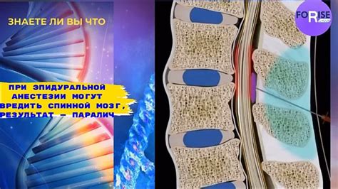 Раковые проблемы: опасные опухоли могут сжимать спинной мозг и вызвать паралич