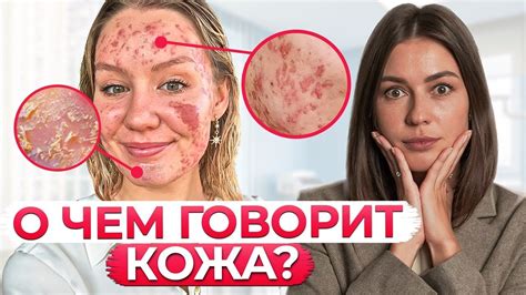 Рассмотрение повседневных привычек для устранения неприятных высыпаний на коже