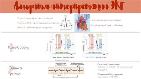 Результаты ЭКГ: как информация помогает в диагностике