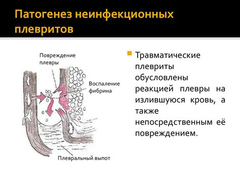 Результаты анализа жидкости в плевральной полости