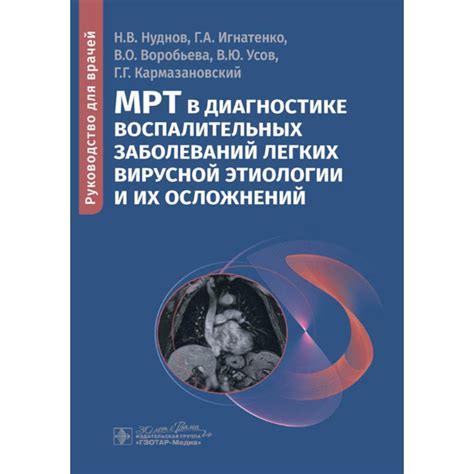 Результаты клинических испытаний нового лекарства в лечении воспалительных заболеваний легких