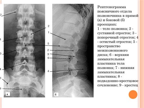 Рентген поясницы при болях