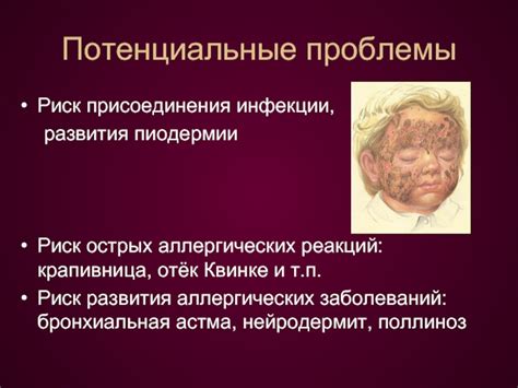 Риск развития аллергических реакций