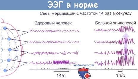 Роль эмоциональных состояний в появлении падений во время сна и пробуждения