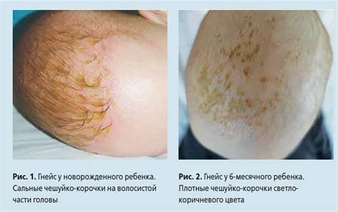 Секреты для хрустящей корочки на голове