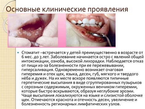 Сильное раздражение кожи и слизистых оболочек головы