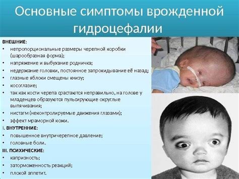 Симптомы наружной гидроцефалии мозга у взрослых
