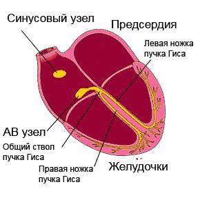 Симптомы нарушения атриовентрикулярной проводимости