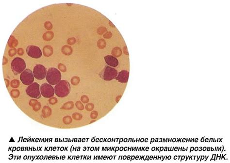 Симптомы нарушения белых кровяных клеток