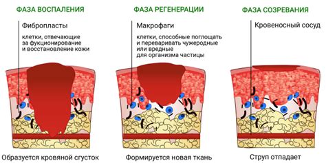 Симптомы ожога на пальце