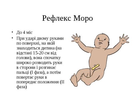 Симптомы рефлекса Моро