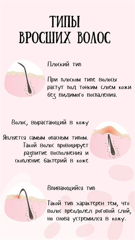 Снижение риска вросших волос