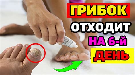 Сны о сгнивших ногах как предупреждение о возможных болезнях